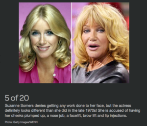 celebrity plastic surgery